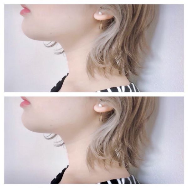 image_list